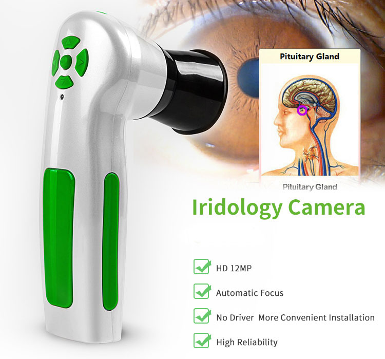 Automatic iris analysis system